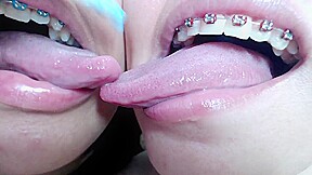 Deep tounge kissing between two brace lesbian